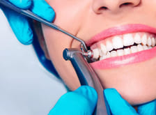 Фото Услуги стоматологии: Чистка зубов Фото Услуги стоматологии: Чистка зубов.