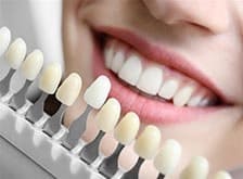 Фото Услуги стоматологии: Отбеливание зубов Фото Услуги стоматологии: Отбеливание зубов.