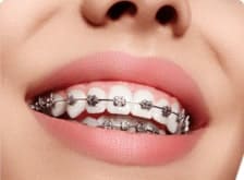 Фото Услуги стоматологии: Ортодонтия Фото Услуги стоматологии: Ортодонтия.