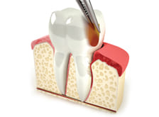 Фото Услуги: Пародонтология Фото Услуги: Пародонтология.