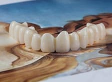 Фото Услуги стоматологии: Протезирование зубов Фото Услуги стоматологии: Протезирование зубов.